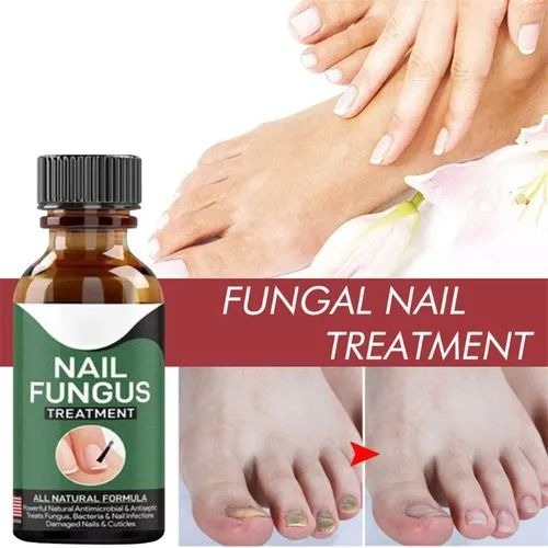 Fast Nail Fungus Treatment Serum – Nail Repair Essence for Finger & Toenail Care